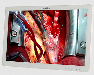Монитор хирургический FHD S2421P